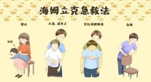 海姆立克急救法